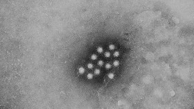 An electron micrograph of the Hepatitis A virus (HAV)