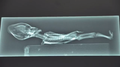 X-ray of alleged extraterrestrial