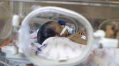 A Premature Baby 