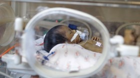 A Premature Baby 