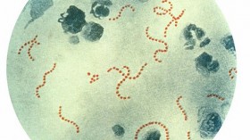 S. pyogenes bacteria at 900x magnification.