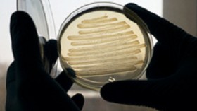 E. coli bacteria