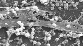 Staphylococcus aureus biofilm on an indwelling catheter