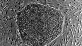 Human embryonic stem cell colony on mouse embryonic fibroblast feeder layer