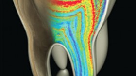 This molar tooth model with the cut face shows color-coded barium patterns merging with a microscopic map of growth lines