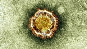 Virus