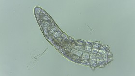 Demodex folliculorum