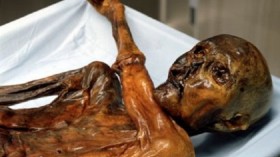 Ötzi the Iceman