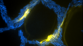 Extracellular DNA (yellow) in biofilms of the bacteria Pseudomonas aeruginosa organising traffic flow