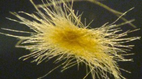 Colony of Trichodesmium bacteria roughly the size of the head of a pin