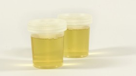 Urine Test