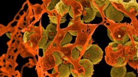 Methicillin-Resistant Staphylococcus aureus (MRSA) Bacteria