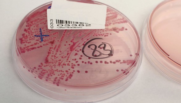  A bacteria culture that shows a positive infection of enterohemorrhagic E. coli