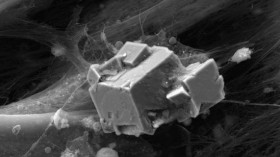 Artificial bone, or mineralization of the extracellular matrix obtained by the Granada-based scientists