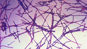 Photomicrograph of a Gram stain of the bacterium Bacillus anthracis, the cause of the anthrax disease