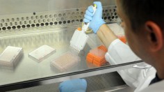 Researchers In Genetic Surgery At Temple University Develop Technique To Eliminate HIV In Human Cells