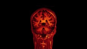 MRI brain scan on Vimeo