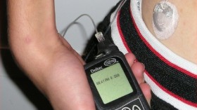 Insulin pump with infusion set