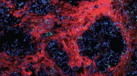 Immune-Based Therapy in Mice Shows Promise against Pancreatic Cancer