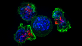 Killer T cells surround a cancer cell