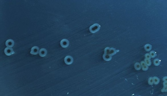 Salmonella Typhimurium colonies on a Hektoen enteric agar plate