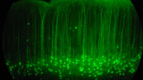 Somatosensory cortex of a mouse brain slice - GFP expressed - 20x magnification