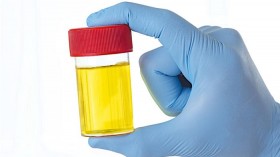 Urine sample