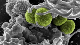 Hospital-Associated Methicillin-resistant Staphylococcus aureus (MRSA) Bacteria