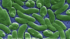 Vibrio vulnificus