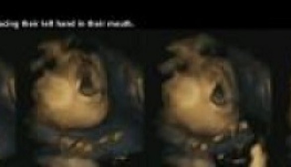 The image is a sequence showing a fetus at 32 weeks anticipating touch. The fetus opens its mouth before putting its hand in its mouth. 