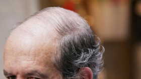 Baldness Drug Shows Promise And Danger In Fighting Cancer