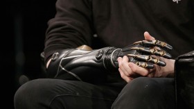 3-D Printing May Be the Future of Prosthetic Science