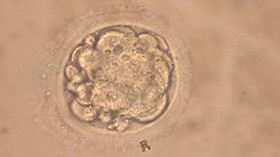 Mitochondrial Replacement can be the future of human reproduction