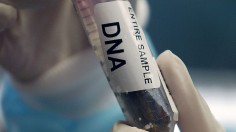 DNA