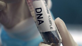 DNA