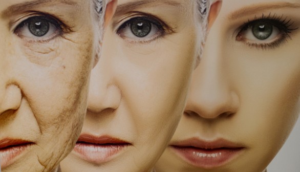 anti-aging