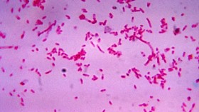 Fusobacterium novum after being cultured in a thioglycollate medium.