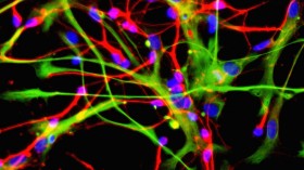 Scientists Discover New Communication Method From Neurons, How Does It Work