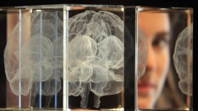 The Wellcome Collections Unveils Their New Exhibition Brains