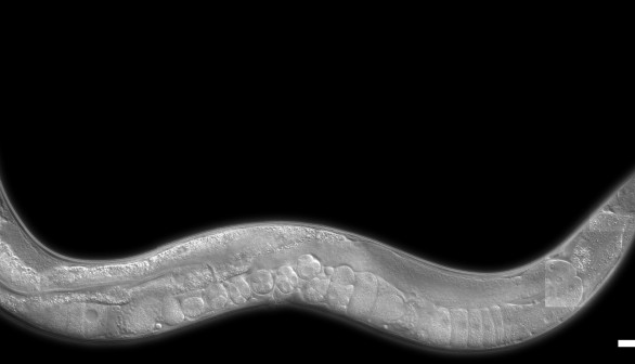 Caenorhabditis elegans roundworm