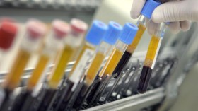 Israeli Laboratory Leads Western World In Blood Testing