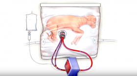 Recreating the womb: New Hope for Premature Babies