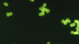 S. pneumoniae in spinal fluid. FA stain (digitally colored).