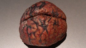 Brain