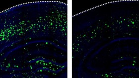 3K3A-APC Suppresses Amyloid-β Accumulation 