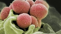 Using AI, Scientists find Trigger that Turns Group A Strep into Flesh-Eating Disease (IMAGE)