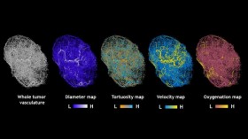 Maps of Tumors Grown in Mice (IMAGE)