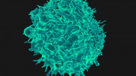 T Lymphocyte (IMAGE)