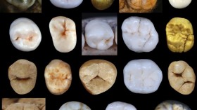 Hominin Teeth (IMAGE)