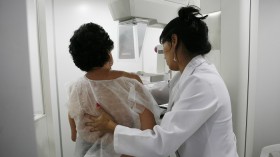 Mammogram